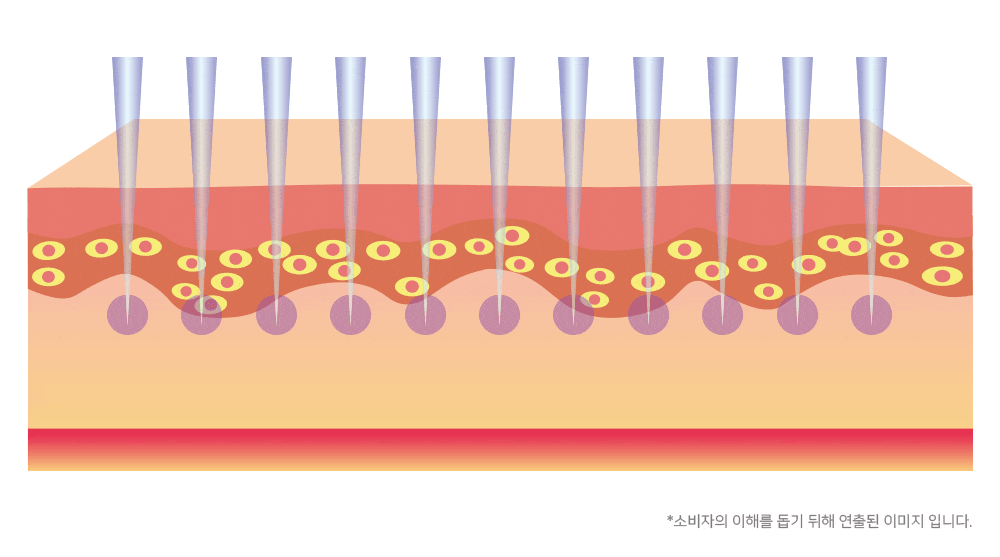 프로페셔널 미용기기