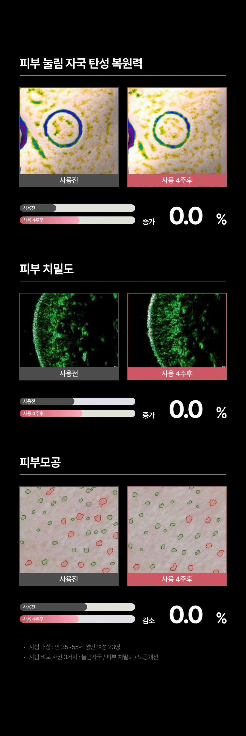 홈쎄라 베이직케어 2.0 (5만샷 100만도트)