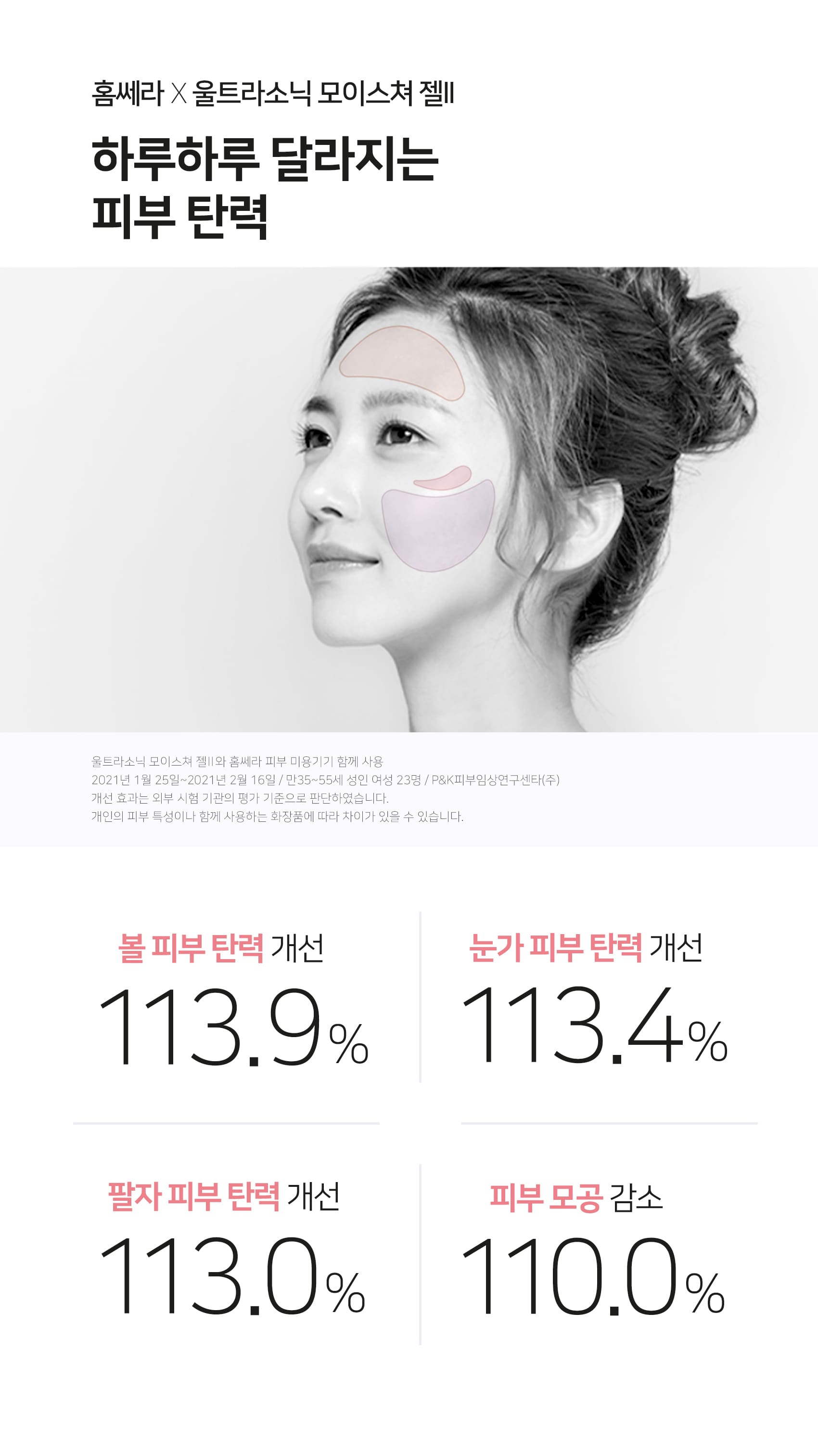 홈쎄라 베이직케어 2.0 (5만샷 100만도트)