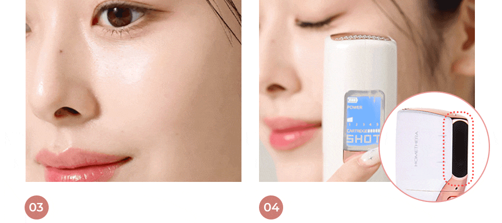 홈쎄라 듀얼케어 2.0 + 4.5 (10만샷 200만도트)